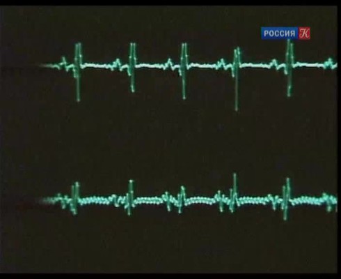 Смотреть