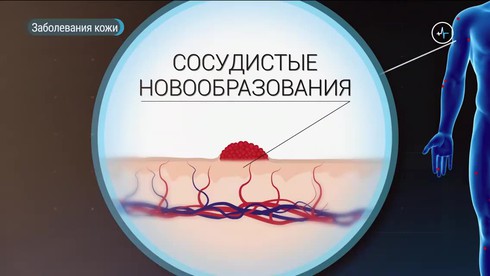 Смотреть