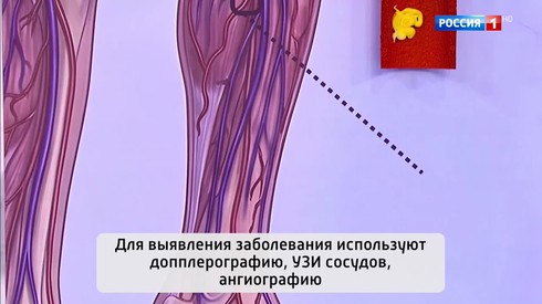 Смотреть